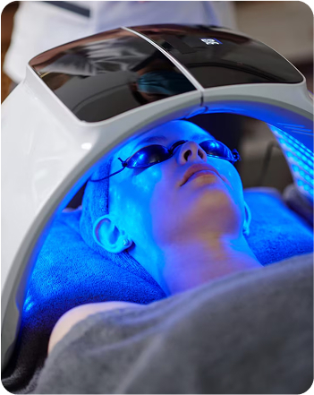 Acne Treatment Services